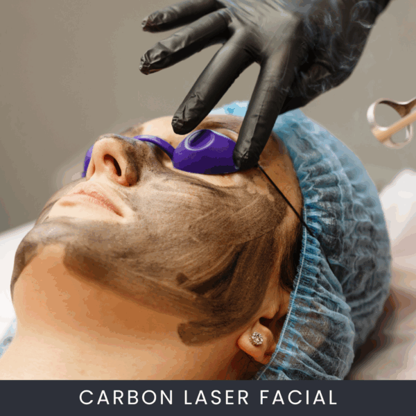 Carbon-Laser-Facial Online Cursus Carbon Laser