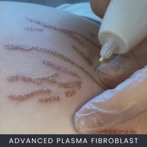 Online Cursus Advanced Plasma Fibroblast