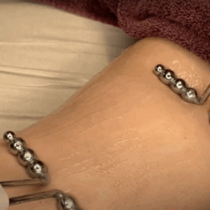 Online Cursus Microcurrent Lichaam
