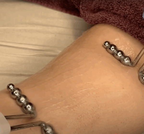 Online Cursus Microcurrent Lichaam